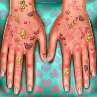 Free online flash games - Hand Skin Doctor game - Games2Dress 